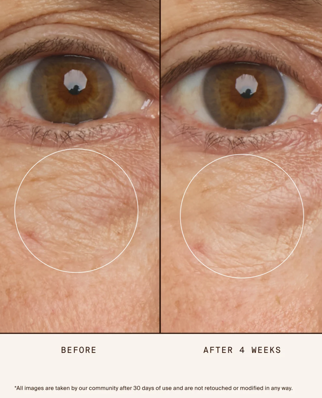 True Botanicals - Chebula Multi-Corrective Eye Patches