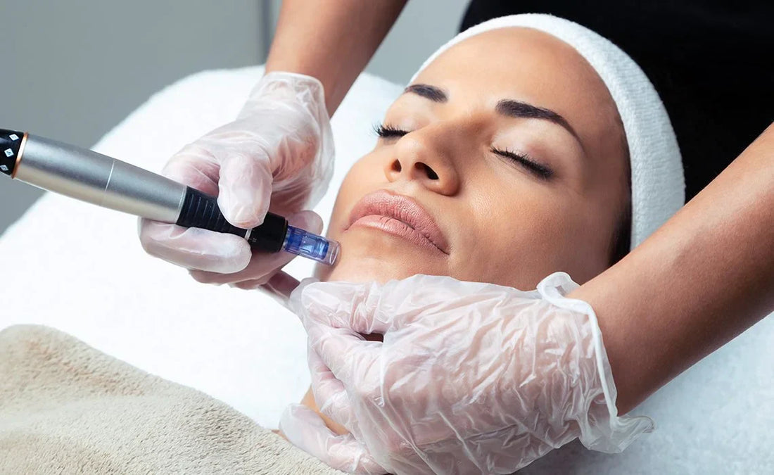 The 411 on Microneedling aka Collagen Induction Therapy.
