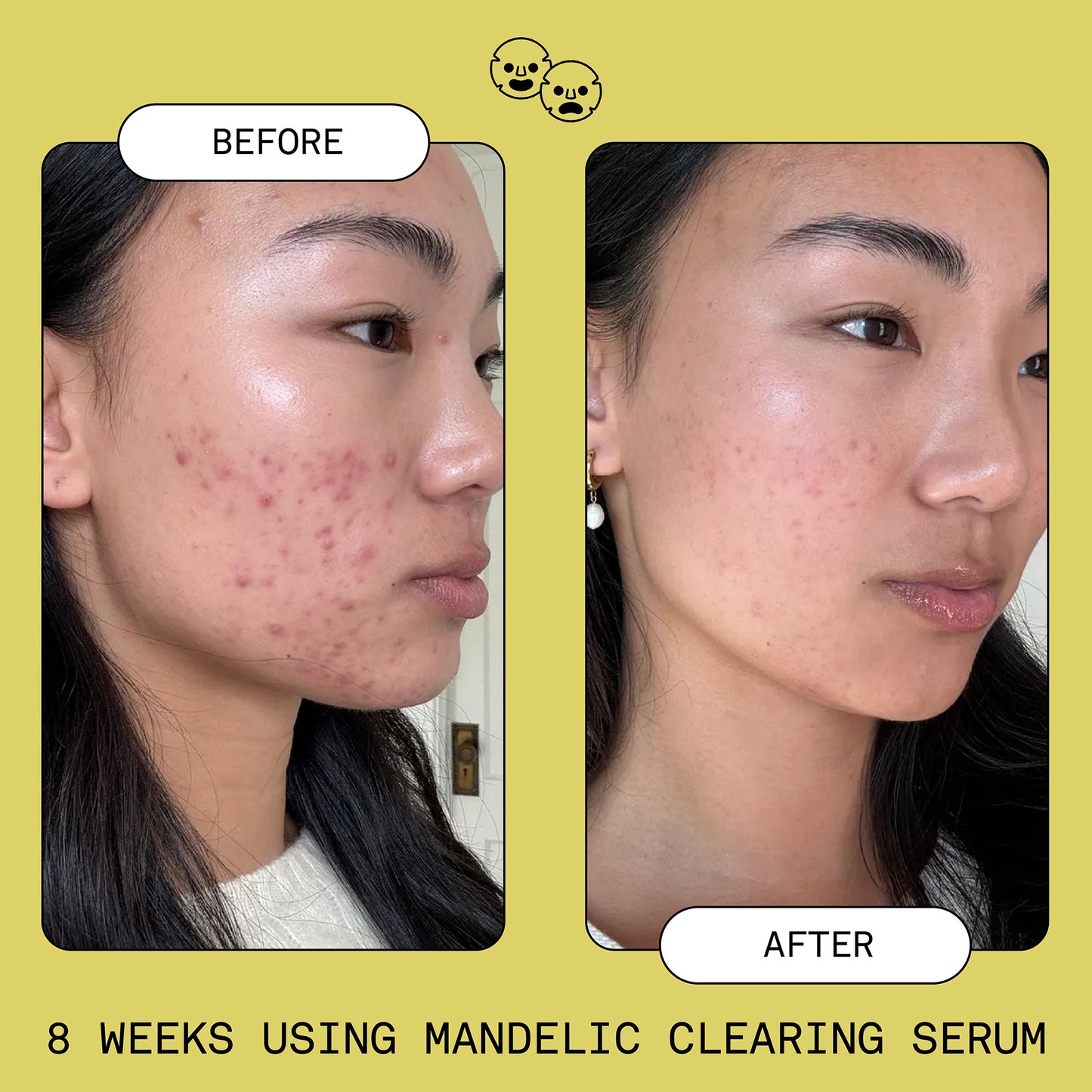 Sofie Pavitt - Mandelic Clearing Serum